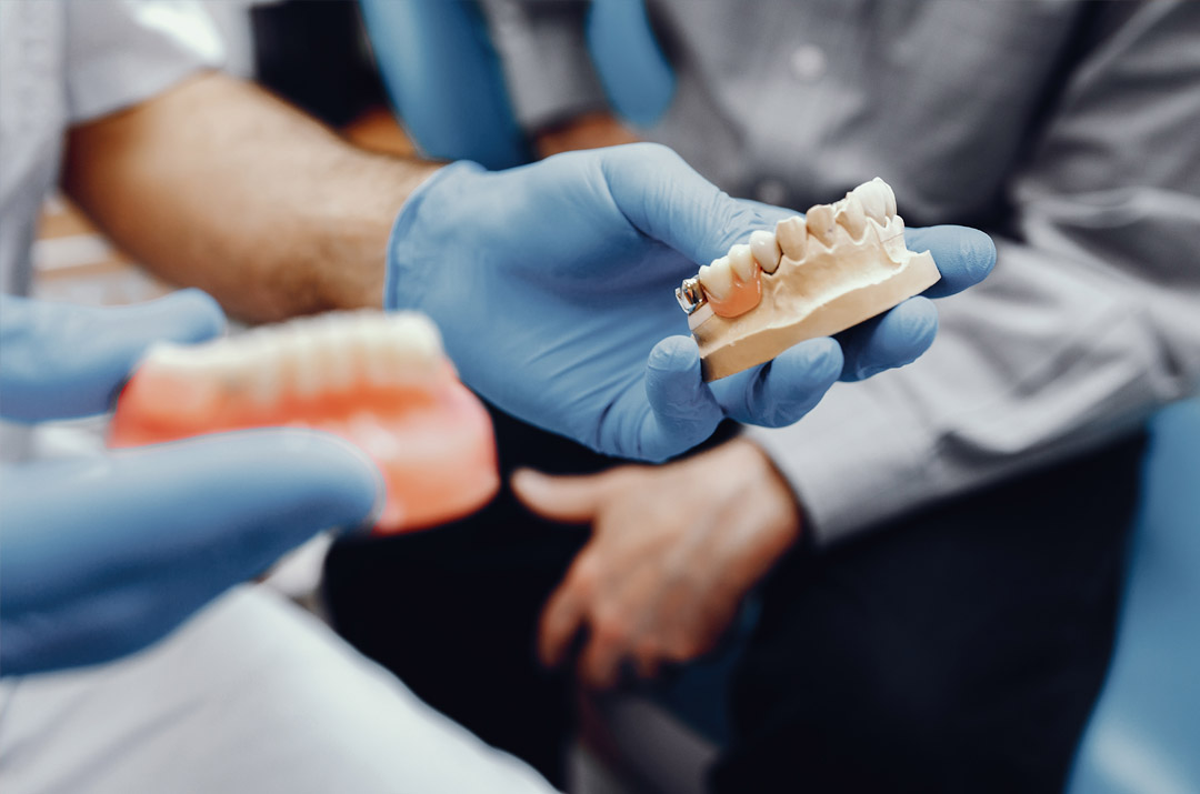 стоматологический блок из диоксида циркония для стоматологической реставрации