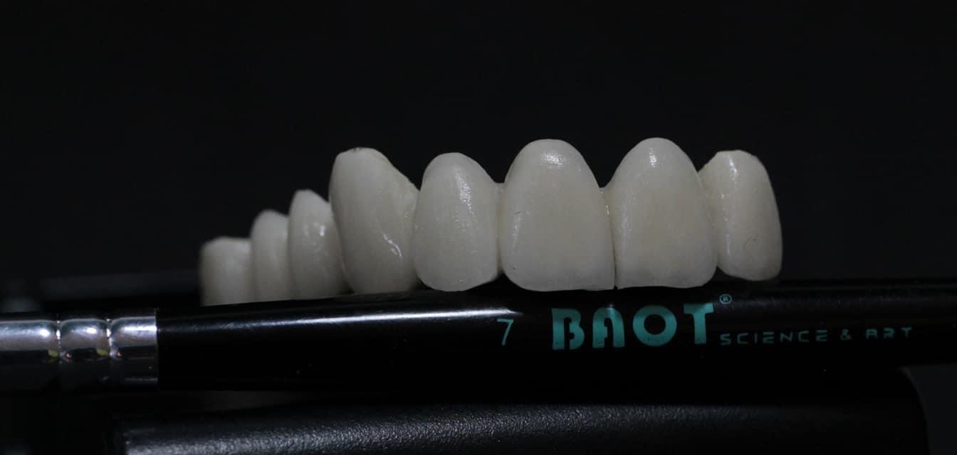 металлический керамический порошок для стоматологической лаборатории