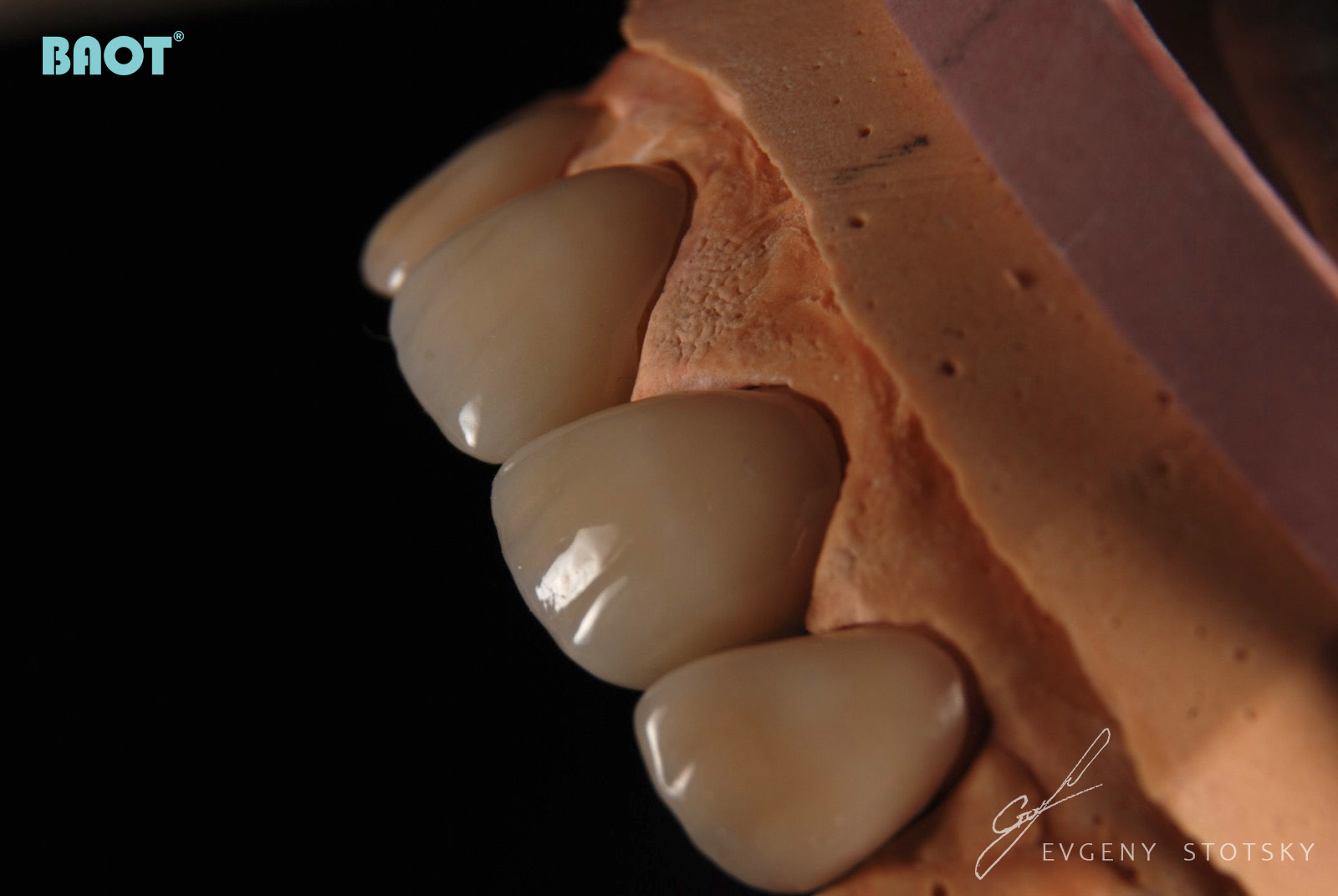 Порошок стоматологического керамического материала для реставрации