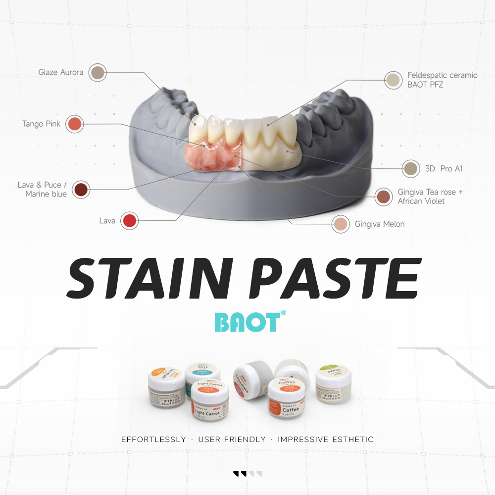 Набор структурной глазури для стоматологических пятен для лаборатории