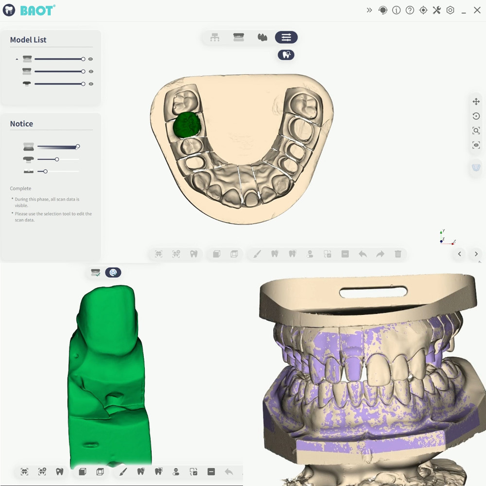 Стоматологический 3D-сканер Сканирование нижней челюсти