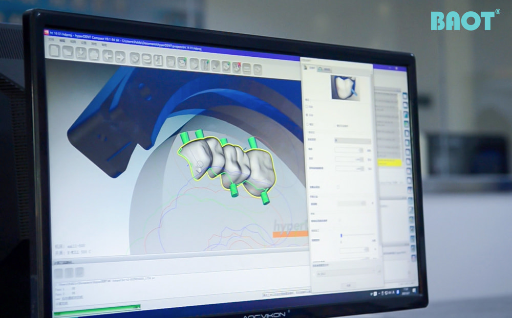 CAD/CAM Design of Zirconia Dental Crown For Digital Dentistry Application