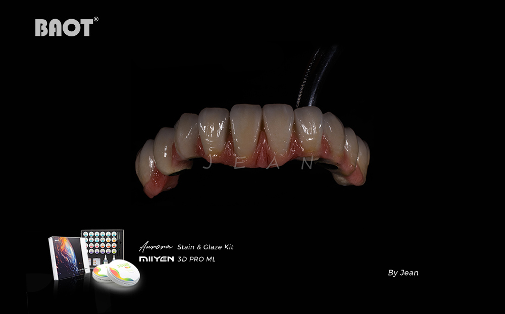 MIIYEN Dental Zirconia Blocks Showing Multi-Layer Translucency and Natural Shade Gradient