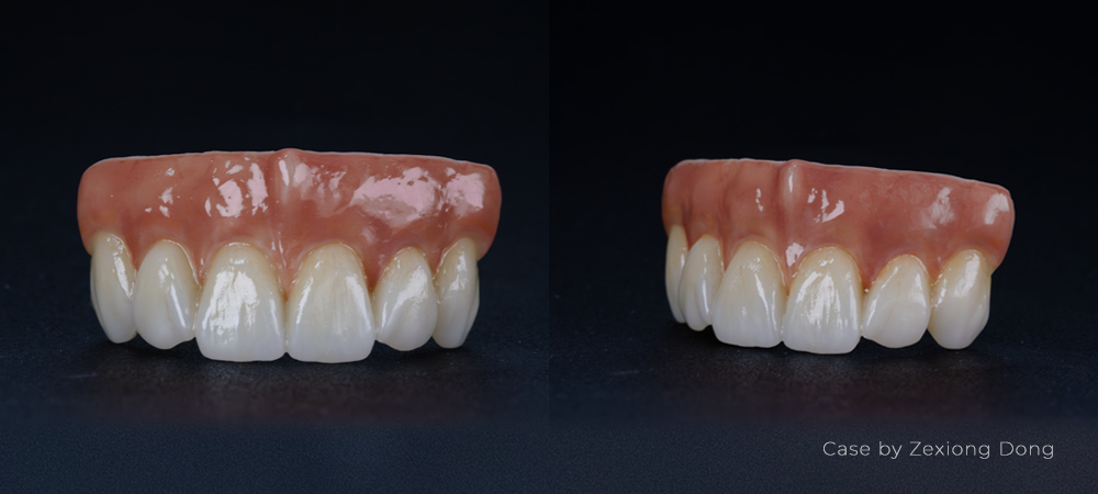 BAOT Pink Gingiva Stain Dental Lab Case 