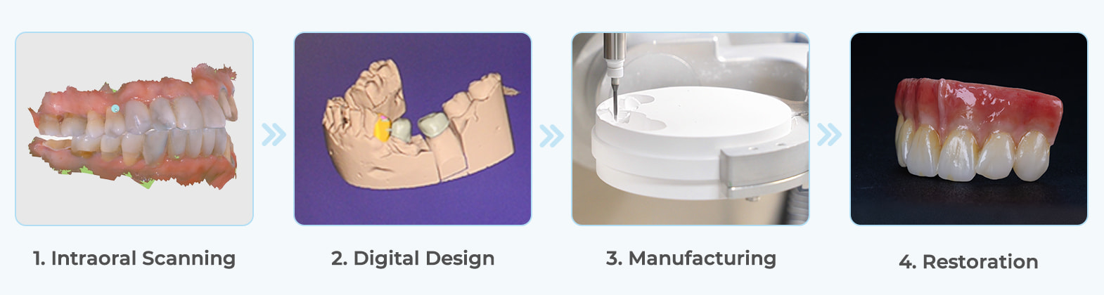 BAOT MS02 intraoral scanner integrated into a digital dental CAD/CAM workflow