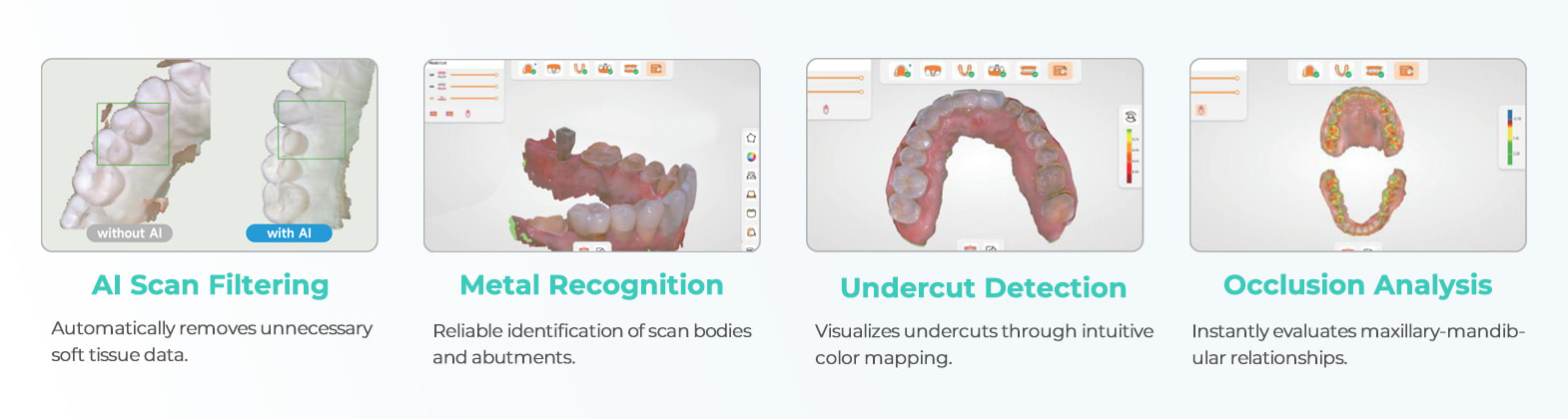 BAOT MS02 AI-assisted intraoral scanning with scan filtering, metal recognition, undercut detection, and occlusion analysis